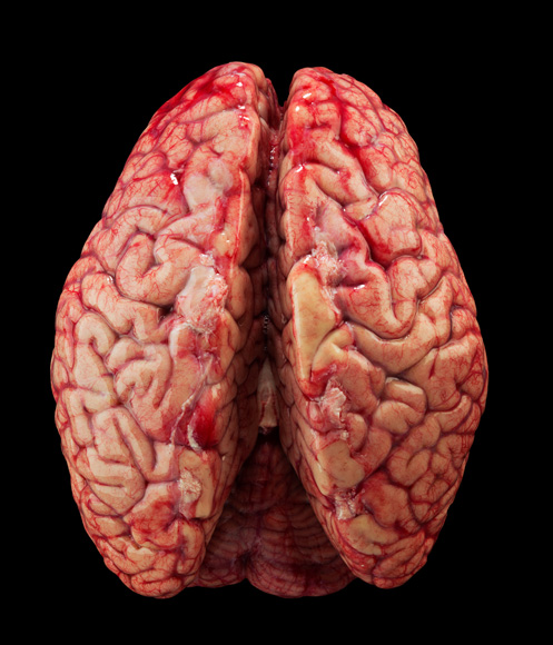 Photograph by Robert Clark; brain preparation performed at Allen Institute for Brain Science