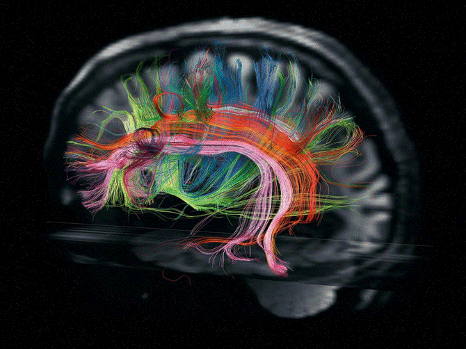 Photograph by Robert Clark; brain preparation performed at Allen Institute for Brain Science. Image by Van Weeden and L. L. Wald, Martinos Center for Biomedical Imaging, Human Connectome Project